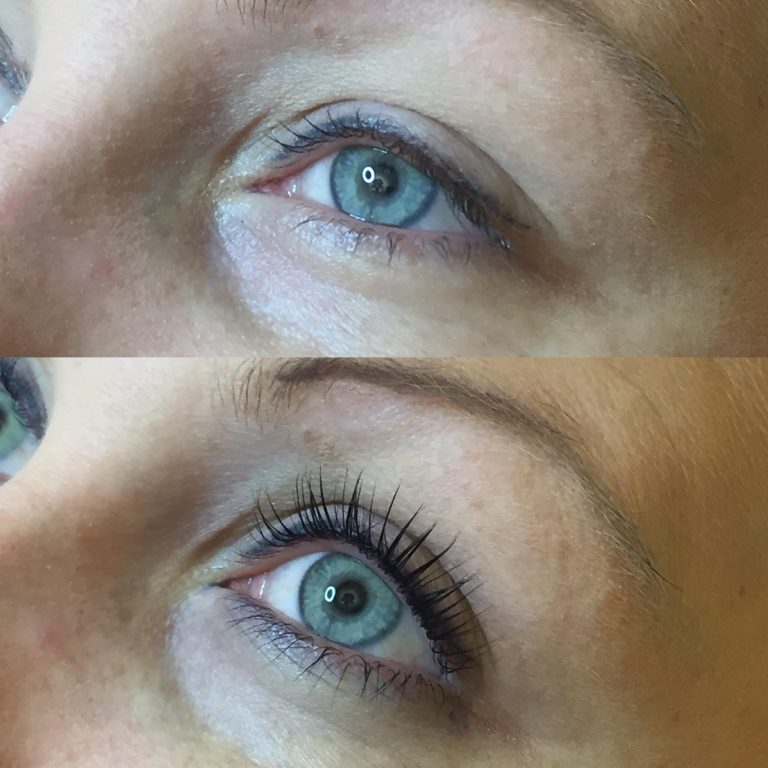 before_and_after